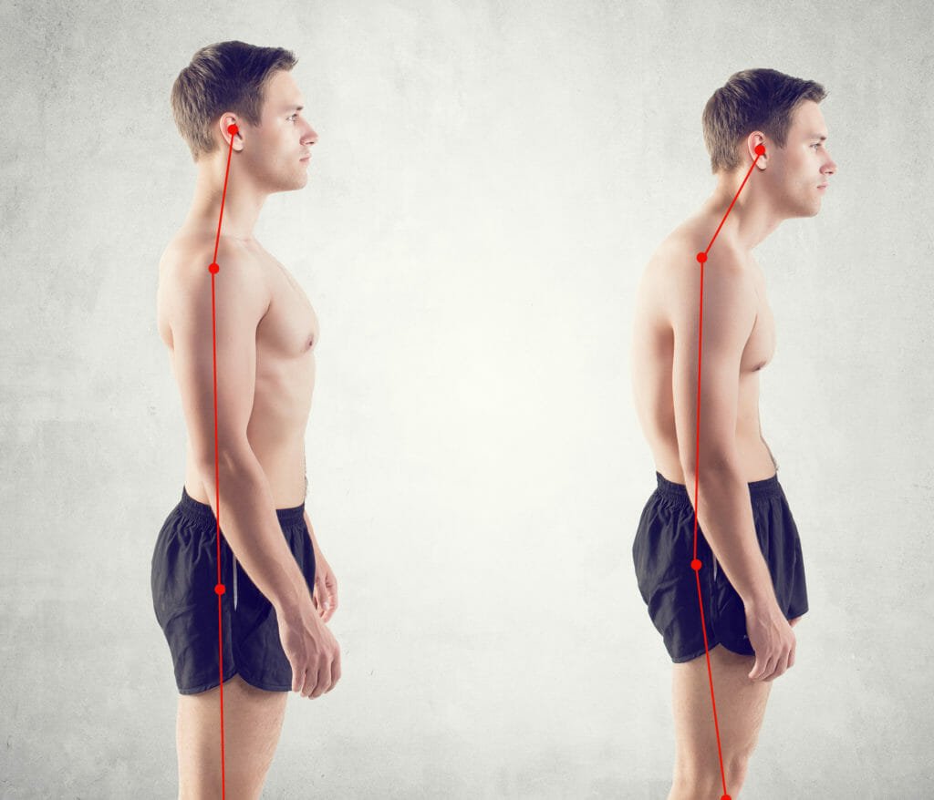 How to Fix Body Posture With Exercise